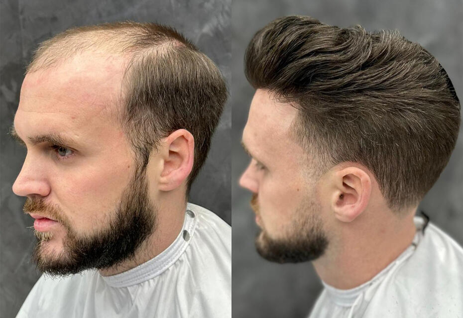 Considering Hair Extensions for Men Hair Extensions for Men